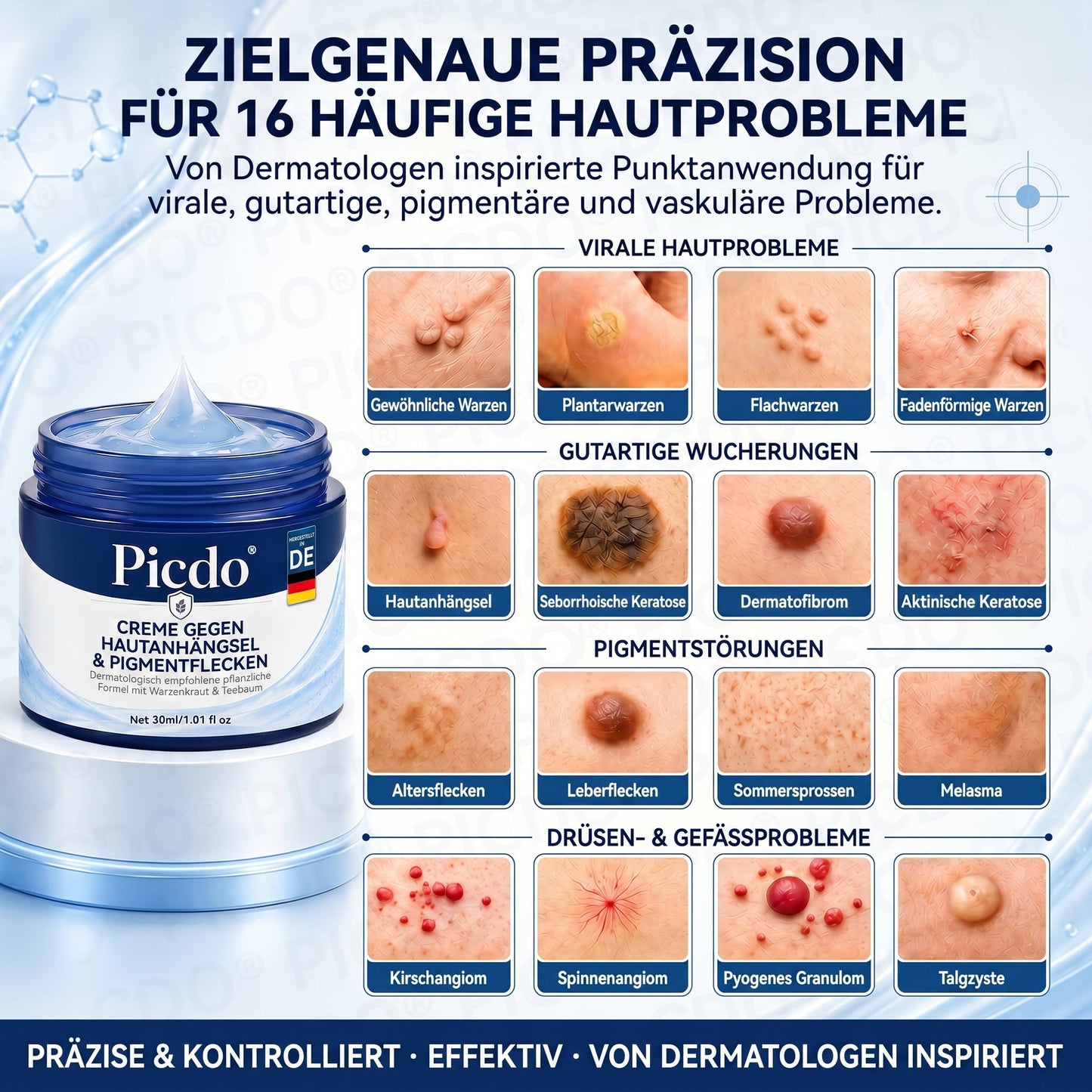 𝐏𝐢𝐜𝐝𝐨® 𝟕-𝐓𝐚𝐠𝐞 𝐇𝐚𝐮𝐭𝐚𝐧𝐡ä𝐧𝐠𝐬𝐞𝐥- & 𝐅𝐥𝐞𝐜𝐤𝐞𝐧-𝐄𝐧𝐭𝐟𝐞𝐫𝐧𝐮𝐧𝐠𝐬𝐜𝐫𝐞𝐦𝐞 (𝐒𝐜𝐡𝐦𝐞𝐫𝐳𝐟𝐫𝐞𝐢𝐞 𝐅𝐨𝐫𝐦𝐞𝐥 – 𝐨𝐡𝐧𝐞 𝐍𝐚𝐫𝐛𝐞𝐧)🌹🌹🌹